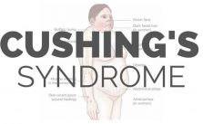 Cushing's Syndrome - Signs, Symptoms, Diagnosis, Treatment