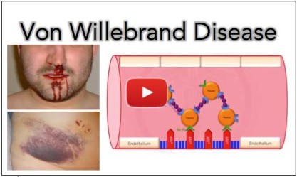 Von Willebrand Disease - Video Tutorial, Sings, Diagnosis&hellip;