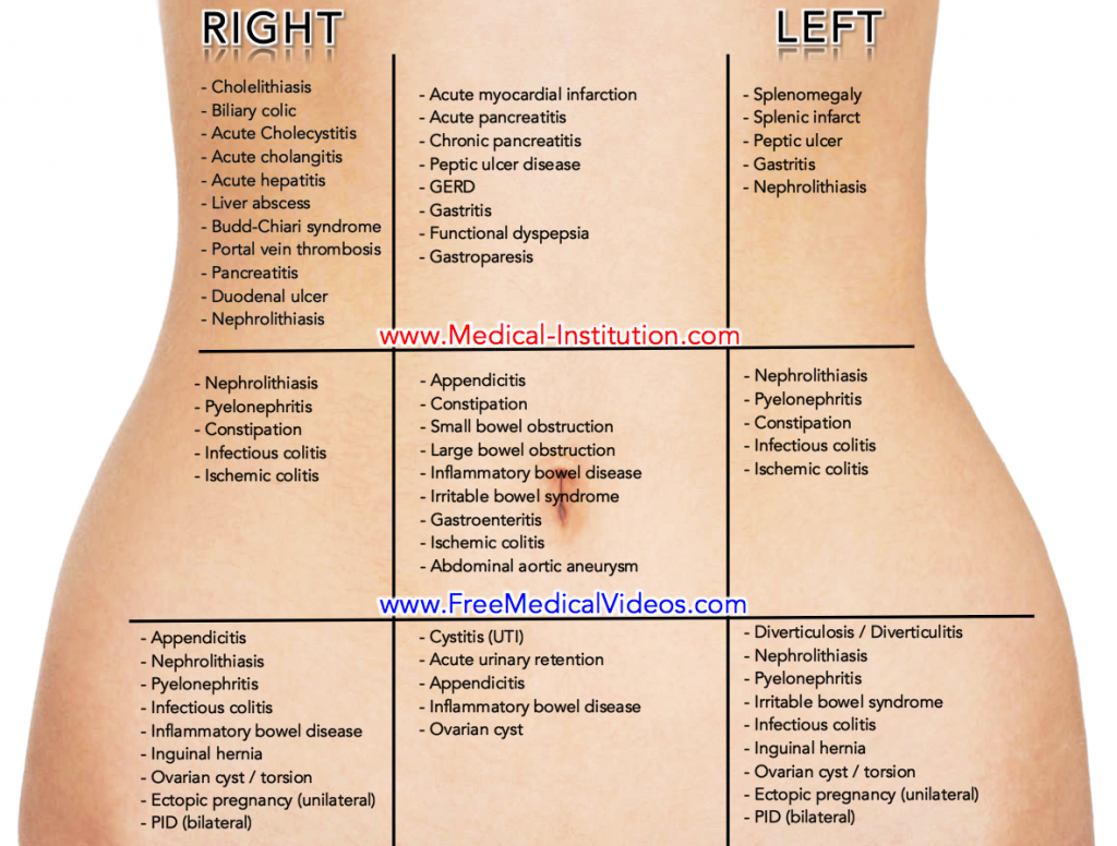 Abdominal Pain Differential Diagnosis Medical Institution Best Medical Website 1 1024x776 